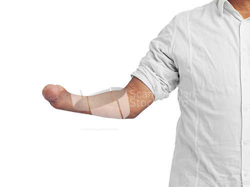 Image of Disability, amputee and arm of a man with a disability showing forearm stump with mockup. Isolated, disability model and white background of a disabled person with a unique body and mock up space