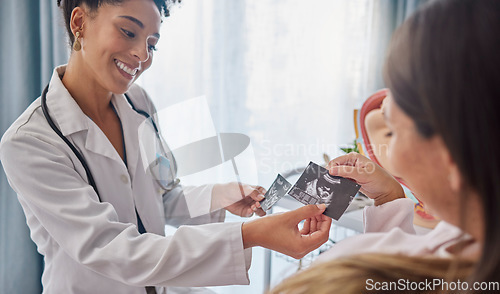 Image of Doctor, pregnant woman and ultrasound photo with happiness, excited and family planning in clinic. Black woman medic, sonogram picture and healthcare for mother patient in hospital for pregnancy care