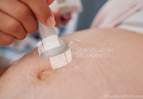 Image of Doctor hand, ultrasound and pregnancy stomach for reading, health and family planning for future mother. Zoom closeup of medic, pregnant woman and sonogram with medical tech on abdomen for healthcare