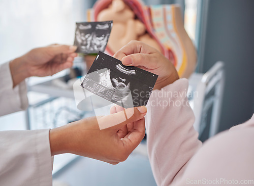 Image of Doctor, hands and woman with ultrasound photo for fetus growth, development or family planning in clinic. Black woman medic, sonogram picture or healthcare for mother patient at hospital in pregnancy