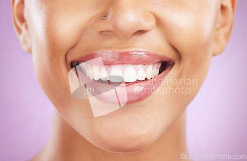 Image of Happy woman, face or dental care on purple studio background or teeth whitening, invisible braces treatment or grooming. Zoom on beauty model smile or cosmetic mouth hygiene and healthcare cleaning