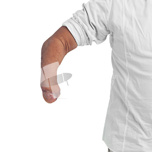 Image of Disability, unique and arm amputee of a man with a injury showing forearm with mockup. Isolated, disabled model and white background of a male person pose with a different body and mock up space