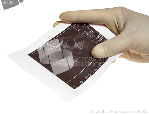 Image of Hands with sonography
