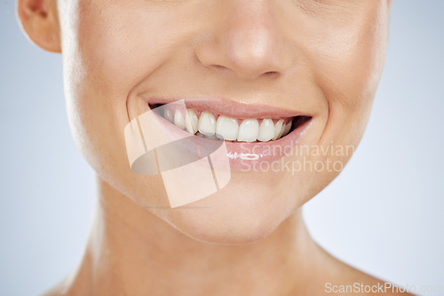 Image of Woman, mouth and smile woth teeth for dental wellness, cosmetics oral care and luxury beauty. Model, facial happiness and clean tooth healthcare or dentist veneers whitening in white background