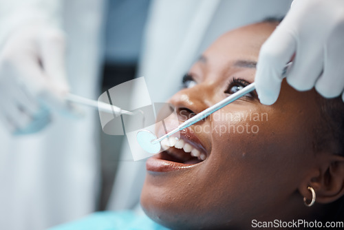 Image of Black woman, mouth and face with dentist, tools in hands and dental, teeth check for healthcare with tooth decay. Tooth surgery, orthodontics and smile, teeth whitening, closeup and Invisalign