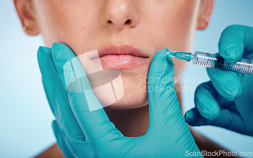 Image of Botox, hands and mouth surgery with a woman and doctor in studio on a blue background for face change. Beauty, skin and injection with a surgeon holding a syringe for female client facial filler