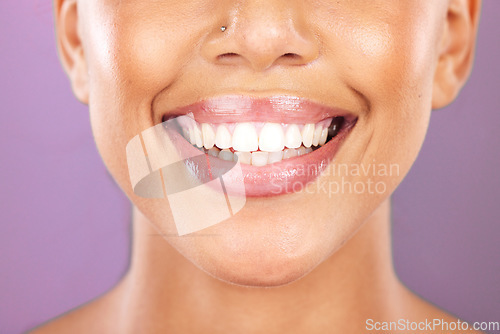 Image of Happy woman, face or dental care on purple studio background or teeth whitening, invisible braces treatment or grooming. Zoom on beauty model smile or cosmetic mouth hygiene and healthcare cleaning