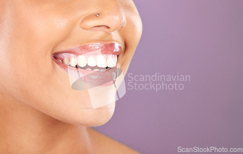 Image of Happy woman, face or dental care on purple studio background or teeth whitening, invisible braces treatment or grooming. Zoom on beauty model smile or cosmetic mouth hygiene and healthcare cleaning