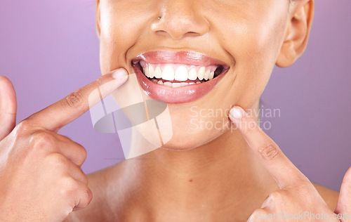 Image of Happy woman, face or dental care on purple studio background or teeth whitening, invisible braces treatment or grooming. Zoom on beauty model smile or cosmetic mouth hygiene and healthcare cleaning