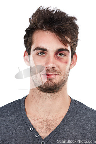 Image of Portrait, man and abuse victim in studio, hurt and bruise, conflict and fight on white background. Face, male and facial injury, black eye and wound, domestic violence and scratches while isolated