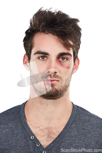 Image of Man, portrait and black eye in studio for fight, conflict and hurt, bruise and abuse victim on white background. Face, male and facial injury, blood and wound, domestic violence and scratch isolated