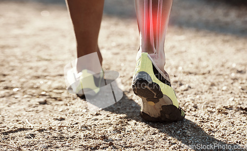 Image of Legs, x ray and pain or injury of hiking fitness athlete training, exercise or workout outdoors and hurt. Closeup, discomfort and red bone for first aid emergency during walk on legs or anatomy