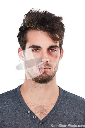 Image of Portrait, injury and man with black eye in studio for bruise, blood and conflict in white background. Face, wound and male after domestic abuse attack, crisis and danger while standing isolated