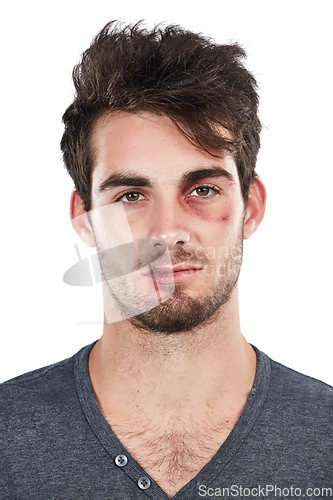 Image of Portrait, facial and injury by man in studio for black eye, accident or fight on white background. Face, danger and domestic violence victim with wound, blood and injured while standing isolated