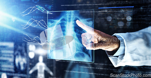 Image of Doctor, healthcare or finger on xray hologram in tuberculosis virus, cancer analytics or asthma x ray at night. Futuristic, abstract or medical lungs scan for surgery planning or hospital woman help