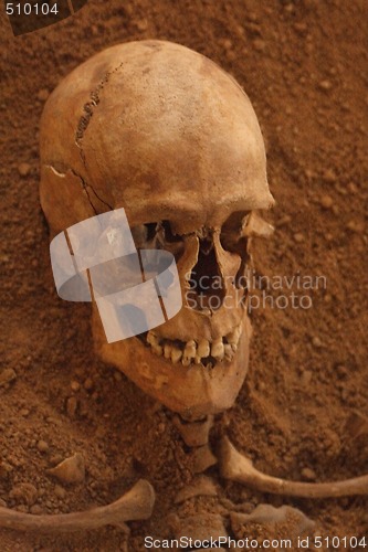 Image of skull