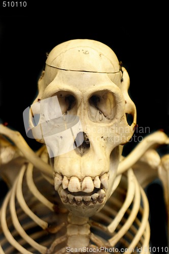 Image of skull