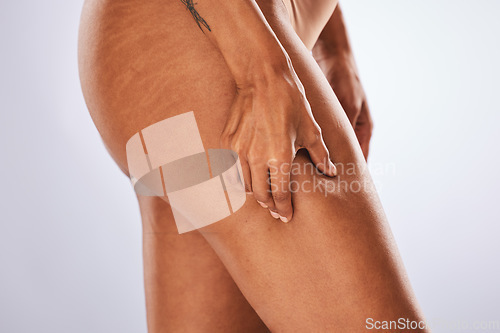 Image of Hands, leg and woman in studio for cellulite, weight loss and diet against a grey background. Hand, legs and girl model holding skin for detox, wellness and body goals while standing isolated