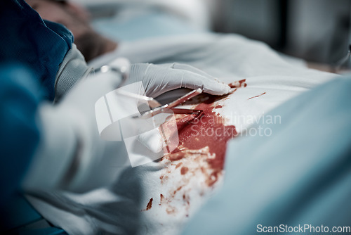 Image of Surgery, blood and doctor hands with medical surgeon scissors for hospital and clinic emergency. Health service, doctors and wellness care of a healthcare worker working on a patient with tools