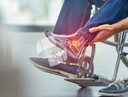 Image of Closeup, man in wheelchair and foot injury with pain, inflammation and accident with torn muscle. Zoom, male and guy in pushchair, highlighted for strained area and disability with broken ankle