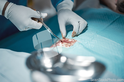 Image of Surgeon hands, blood and doctor in surgery with medical scissors for hospital and clinic emergency. Health service, doctors and wellness care of a healthcare worker working on a patient with tools