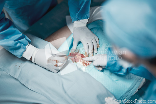 Image of Surgery cut, nursing and doctor hands with medical surgeon scalpel for hospital and clinic emergency. Health service, doctors above and wellness of a healthcare worker working on a patient with blood