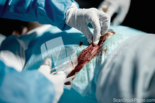 Image of Surgeon hands, cut blood and doctor hand with medical surgeon scissors for hospital and clinic emergency. Health service, doctors and wellness care of healthcare worker working on patient with tools
