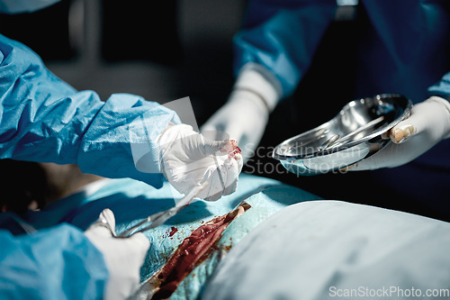 Image of Surgery team, nurses and doctor hands with medical surgeon scissors for hospital and clinic emergency. Health service, doctors and wellness care of a healthcare worker working on a patient with blood