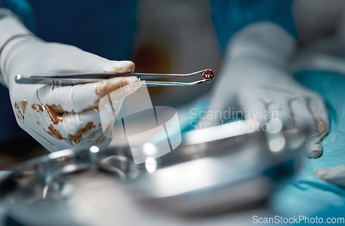 Image of Surgery, blood and motion blur with the hands of a doctor in a hospital for a medical or life saving operation. Healthcare, emergency or medicine with a surgeon at work in an operating room