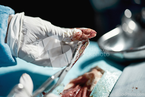 Image of Surgery wound, doctor hands and medical surgeon scissors with blood at hospital and clinic. Health service help, doctors and wellness care of a healthcare worker working on a patient with tools