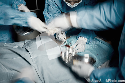 Image of Hands, motion blur and surgery with doctors in a hospital emergency room for a life saving operation. Nurse, teamwork and medical with a doctor and team working in a clinic to save a critical patient