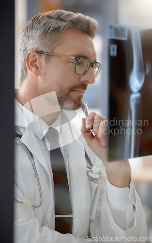 Image of Analysis, healthcare and doctor looking at an x ray for research, body problem and medical results. Medicine, expert and man working in radiology examining a scan for a bone fracture at a hospital