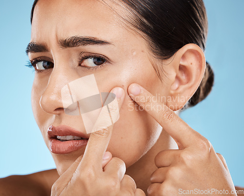 Image of Woman, face and pop pimple with acne, anxiety and stress, beauty and skincare isolated on blue background. Skin problem, facial zoom and cosmetics in portrait, dermatology and cosmetic care in studio