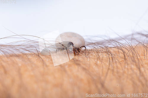 Image of Tick on human hand