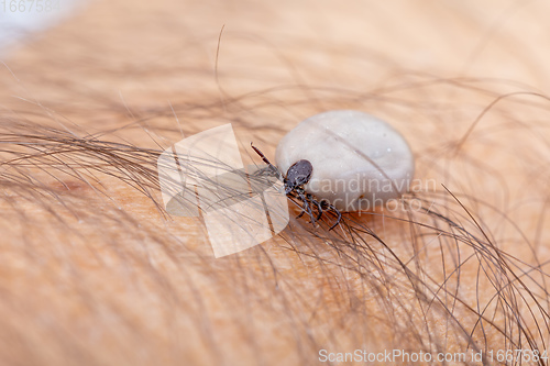 Image of Tick on human hand