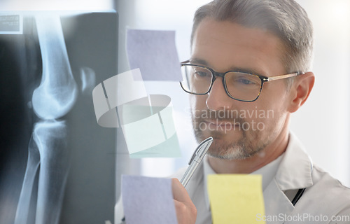 Image of X ray, analysis and doctor thinking of healthcare solution, problem solving and surgery strategy in office glass. Planning, schedule or radiology in medical anatomy of expert or professional person