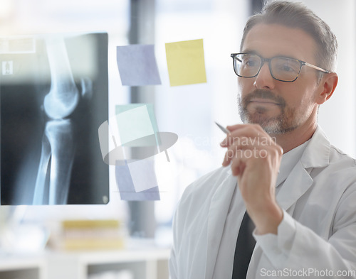 Image of X ray, analysis and doctor writing healthcare research, solution and focus, vision or strategy of skeleton on glass. Planning, schedule and radiology person or professional in medical anatomy career