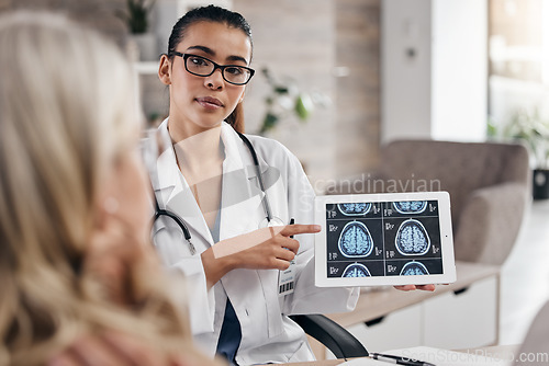 Image of Brain, woman and doctor pointing at tablet, mri scan or xray diagnosis for cancer. Healthcare, advice and neurology patient in doctors office, help consulting on health problem for hospital treatment