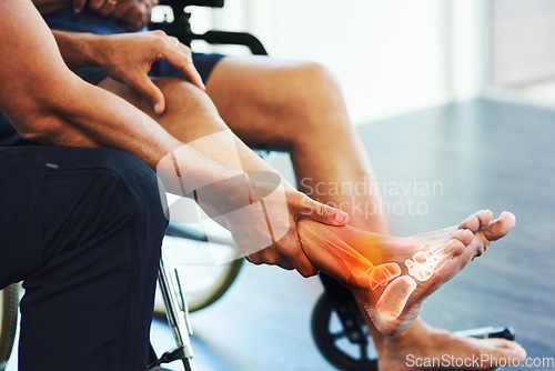 Image of Rehabilitation, physiotherapist and help a patient with foot injury, pain and muscle tension recovery. Physiotherapy, male or doctor assist with strain, movement or wellness with person in wheelchair