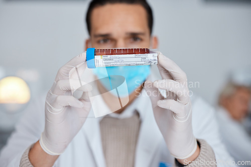 Image of Man, doctor and hands with blood sample, vial or tube for scientific research, testing or exam in lab. Male scientist or medical expert with mask and gloves holding DNA for science test at laboratory