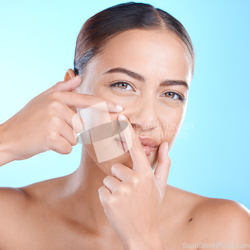 Image of Skincare, acne and portrait of woman with pimple on blue background for wellness, beauty and health. Dermatology, cosmetics and hands on girl face to pop blackhead, skin problem and facial treatment