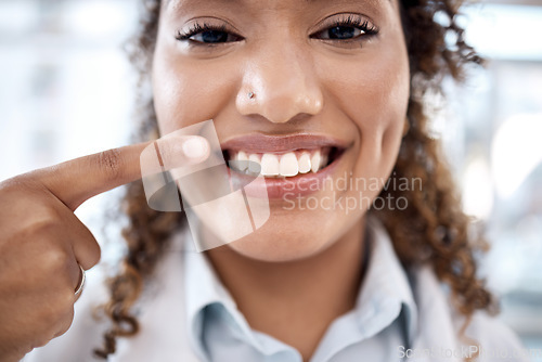 Image of Face of black woman pointing to her teeth whitening results, dentist medical and mouth healthcare in hospital. Professional dental doctor with tooth cleaning services and happy portrait in USA clinic