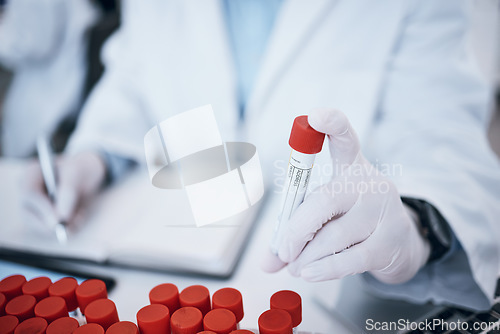 Image of Science, blood and hands with test tube in laboratory for medical research, medicine development and dna testing. Biotechnology, healthcare and scientist with vial for rna exam, study and analysis