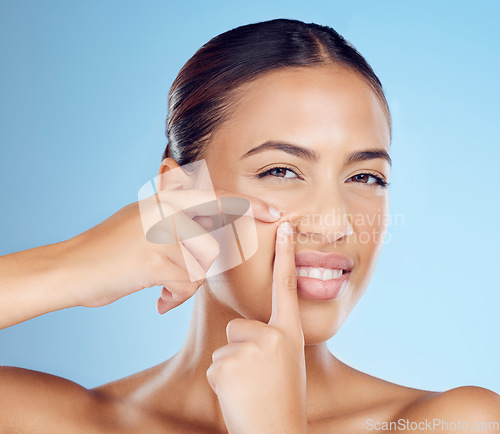 Image of Portrait, pimple and woman in studio for acne, treatment and cosmetic skincare on blue background. Blackhead, spot and face of girl model with facial, breakout or dermatology problem while isolated