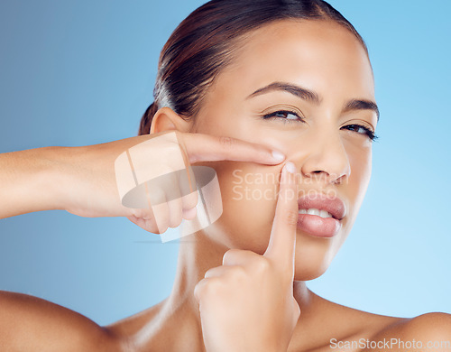 Image of Pimple, portrait and woman in studio for acne, skincare and cosmetic treatment on blue background. Blackhead, spot and face of girl model with facial, breakout or dermatology problem while isolated