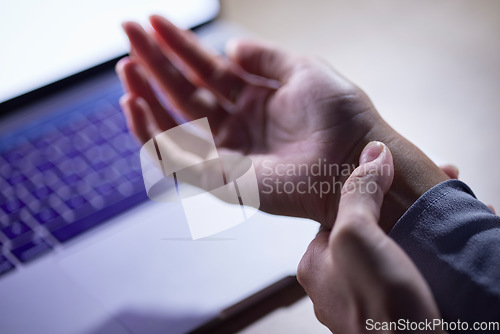 Image of Office, wrist injury and hands with pain after accident while typing on laptop in workplace. Carpal tunnel syndrome, strain and business woman with fibromyalgia, arthritis or inflammation in company.