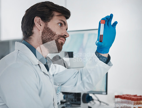 Image of Science, dna and sample with a doctor man at work in a laboratory for analysis or research. Medical, innovation and blood with a male scientist working in a lab for development or breakthrough