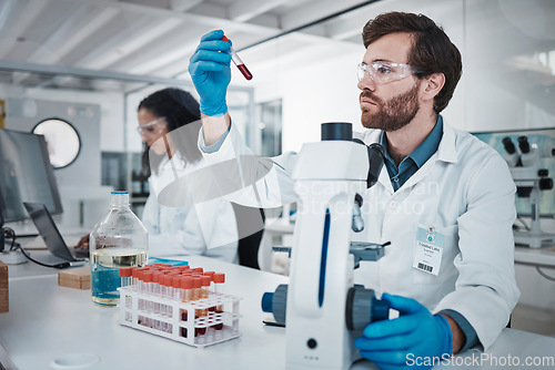 Image of Thinking, scientist or laboratory microscope of blood sample, test tube research or medical vaccine study. Black woman, man or teamwork in healthcare science, dna engineering or pharmacy innovation