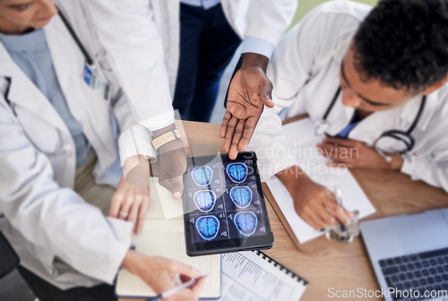 Image of Tablet screen, brain and doctors in neurology research, internship training and teamwork for healthcare solution. Assessment, cancer analysis and xray of medical students or professional people above