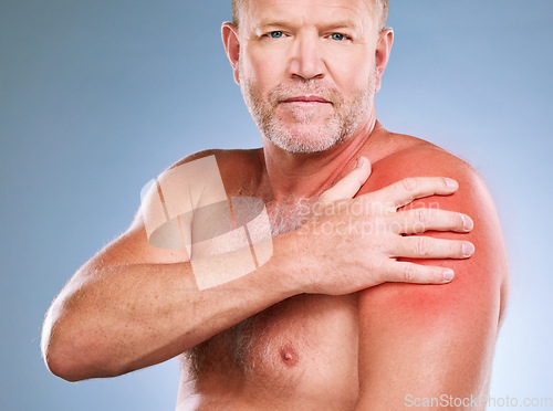 Image of Sunburn, skincare and portrait of a man with red skin color and burn texture in studio. Isolated, blue background and male model looking for wellness, health and soothing solution for body problem